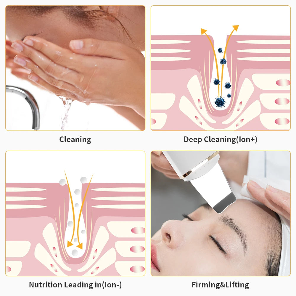 Ultrasonic Deep Pore Cleansing Skin Scrubber