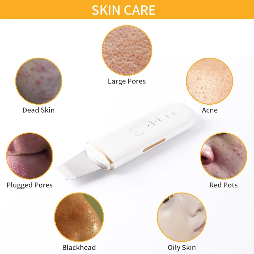 Ultrasonic Deep Pore Cleansing Skin Scrubber